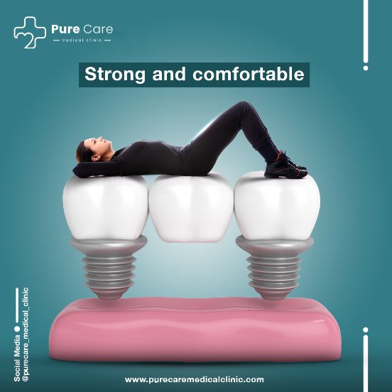 Pure Care dental implant post
